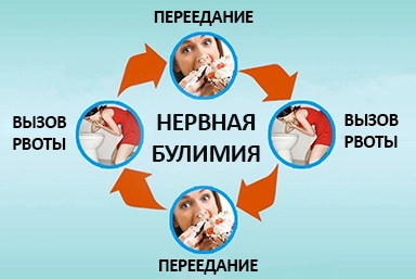 Лечение булимии в Симе